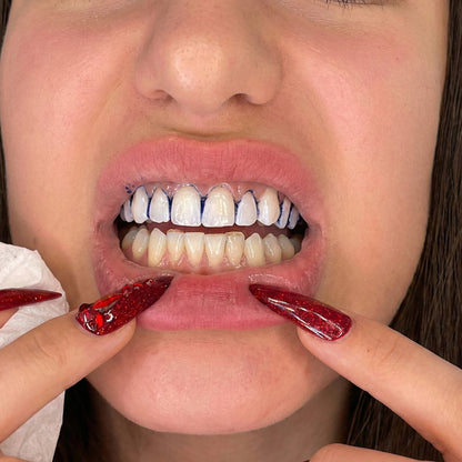 Averine Dental Stripsgentle Care For Clean Teeth